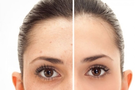 Gesichtsreinigungsbehandlung Mandarin Spa.